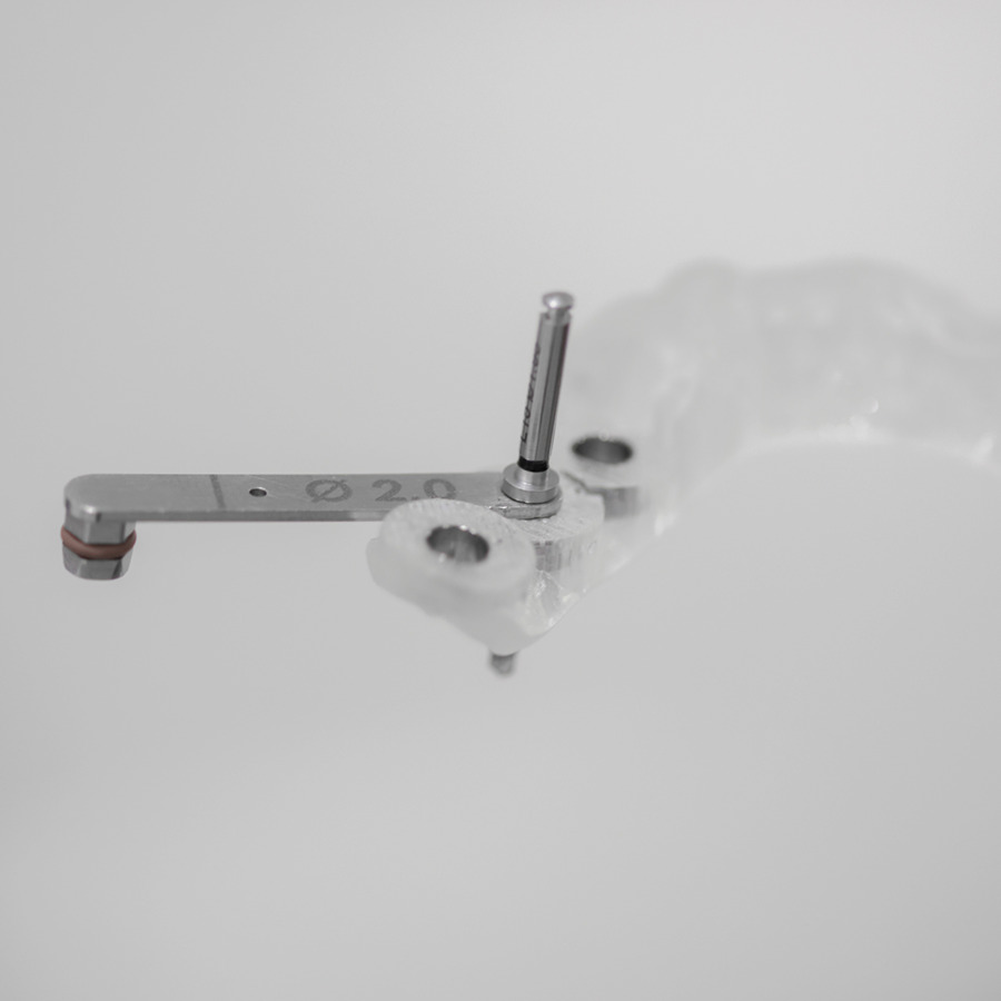 精密インプラント精密義歯(入れ歯)